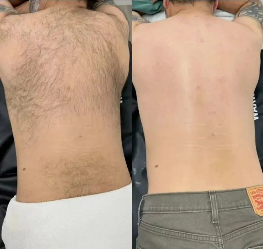 Back — Smooth & Clear