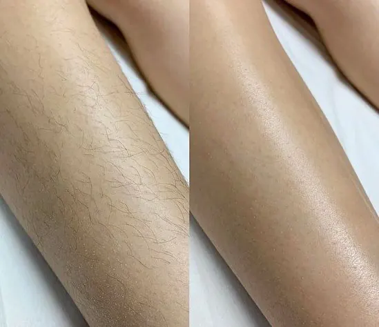 Legs — Silky Smooth